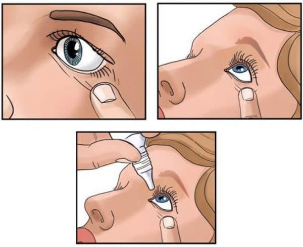 Как правильно закапывать глаза